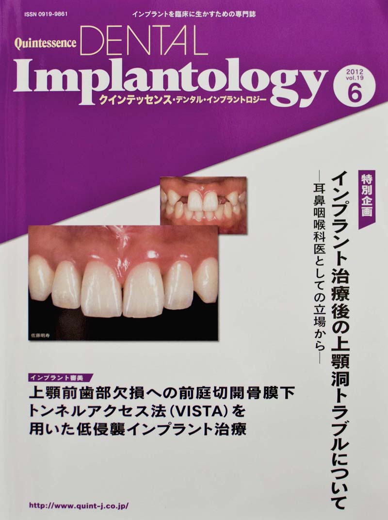 インプラントを臨床に生かすための専門誌 DENTAL Implantology - 健康