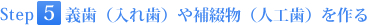 step05義歯（入れ歯）や補綴（人工歯）を作る