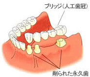 従来の治療法