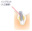 step02