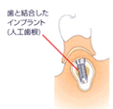 step03