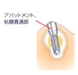 step04