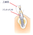 step05